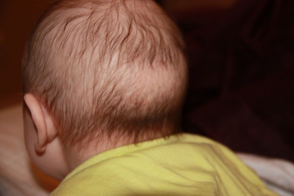婴儿枕秃是不是缺钙 原来这才是造成秃枕的罪魁祸首
