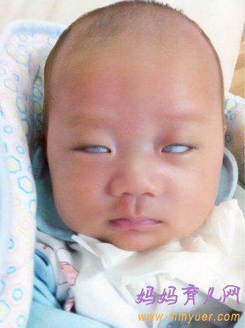 刚出生的宝宝总是翻白眼究竟为哪般？