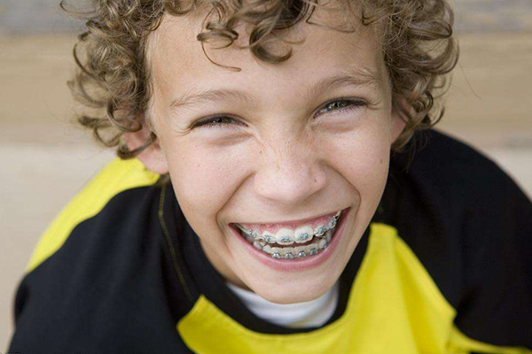 矫正牙套如果儿童已经出现牙齿不齐的现象,并且会阻碍到其他牙齿换牙