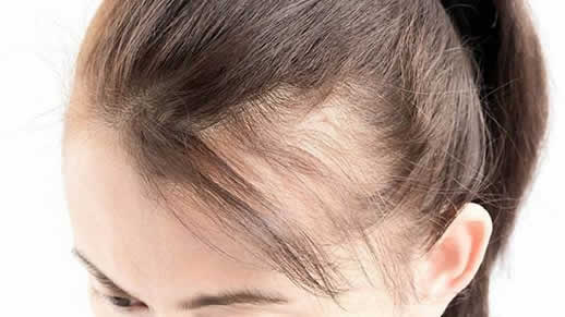 女人掉头发是什么原因：老掉头的各种原因汇总
