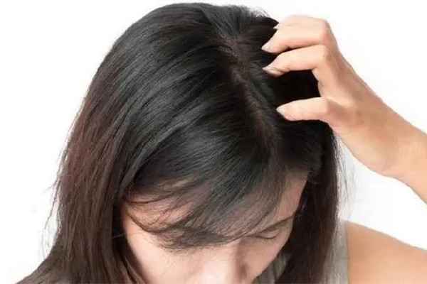 干性头发怎么护理干性头发用有硅油的好一点还是用无硅油好