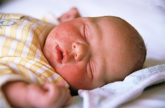 宝宝湿疹多久才能自愈呢 引起宝宝湿疹的原因是什么呢