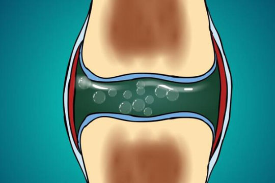 膝盖会响是什么原因 膝盖咔咔响需引起重视