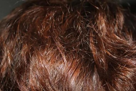 头发干枯毛躁是因为什么呢?如何去预防头发干枯?