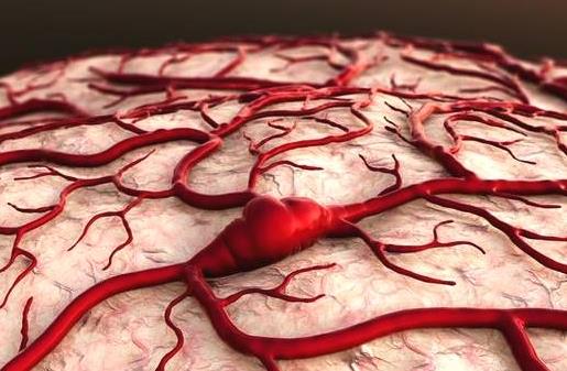 脑出血发生前兆的症状 保持心情舒畅预防脑出血