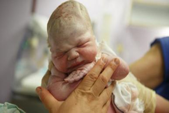 36周出生的婴儿图片图片