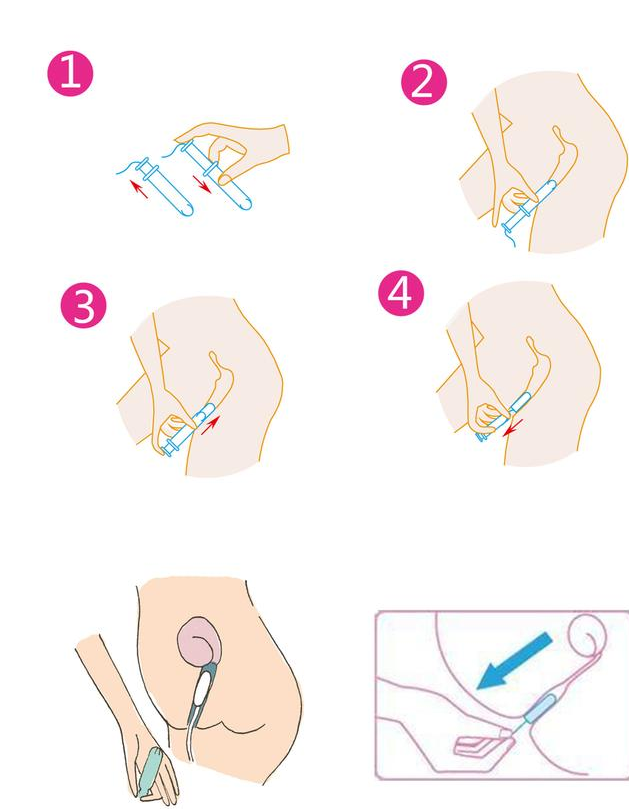 卫生棉条的用法图片 不会侧漏的