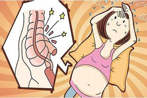 女性阑尾炎的症状图片