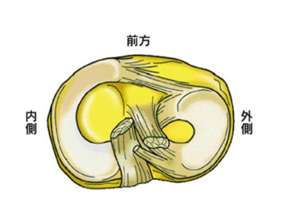 半月板損傷早期症狀