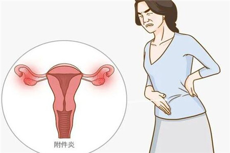 女性附件炎疼痛图片
