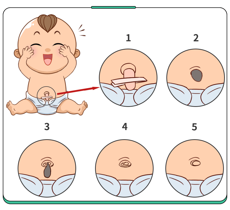 婴儿肚脐正常图图片