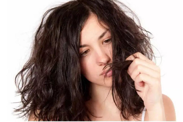 干性头发会变成油性头发吗干性头发会导致头皮屑吗